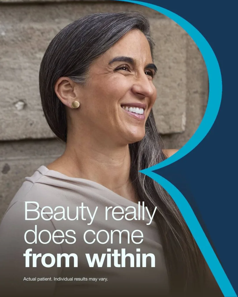 RADIESSE patient smiling outdoors. Actual patient. Individual results may vary.